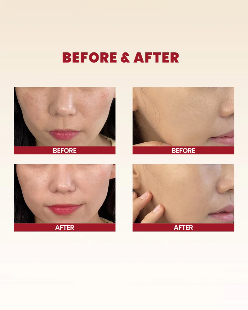 K-SECRET SEOUL 1998 Cream: Snail Mucin 93% + Rice 100ml - Image 7