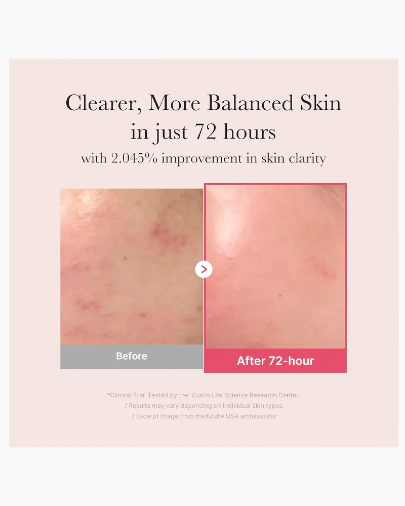 medicube TXA Niacinamide 15 Serum - Image 4
