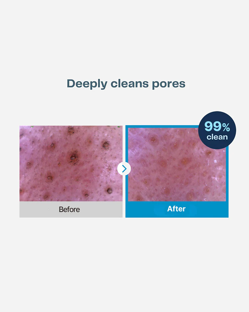 Torriden DIVE-IN Cleansing Oil - Image 6